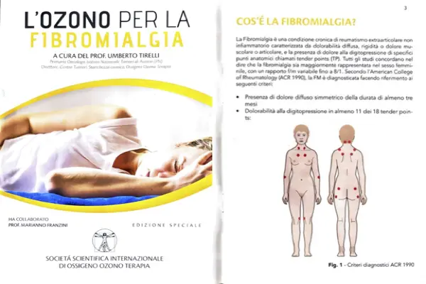 L'ozono per la fibromialgia